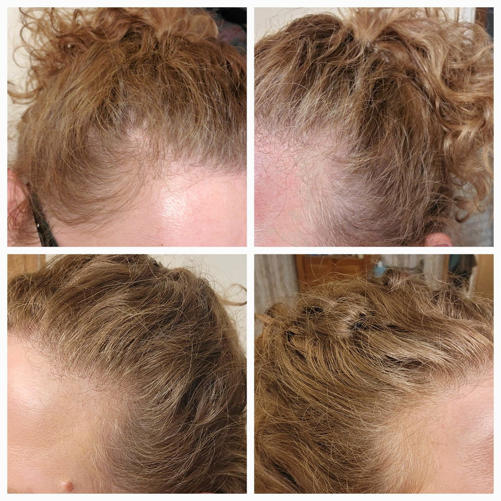 Bounce Curl Hair Vitamins Haarkapseln vegan