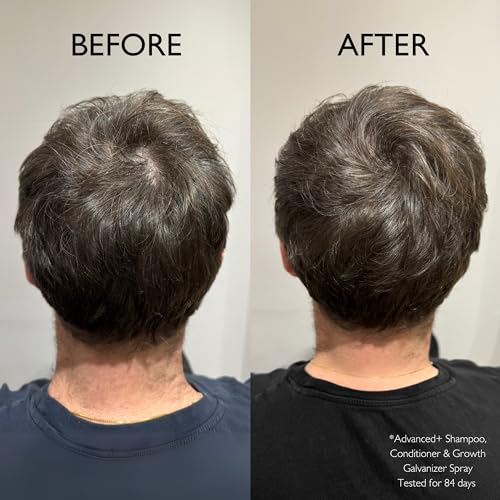 Daimon Hair Care Hair Growth Galvanizer Spray 100ml bei Haarausfall